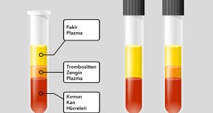 Plazma, kanın sıvı kısmı olarak taşıma, bağışıklık, pıhtılaşma, ısı düzenleme ve kimyasal denge gibi çok yönlü görevler üstlenir. Bu görevler, plazmayı yaşamın devamında vazgeçilmez bir bileşen hâline getirir. Plazmanın yapı ve işlevlerindeki bozukluklar ise ciddi tıbbi sorunlara yol açabilir.